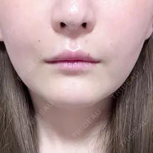 EMMO FACE CLINIC EMMO FACE CLINIC 大宮院口コミ