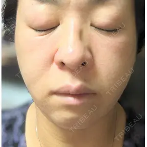 湘南美容クリニック 南青山院の