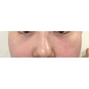 X CLINIC X CLINIC 銀座院口コミ