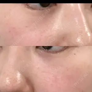X CLINIC X CLINIC 銀座院口コミ
