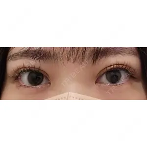 アリエル美容クリニック アリエル美容クリニック 郡山院口コミ