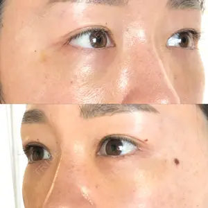 X CLINIC X CLINIC 銀座院口コミ