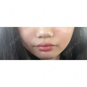 フィラークリニック フィラークリニック 町田院口コミ