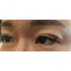 口コミ