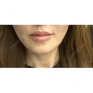 Nebula Clinic ネビュラクリニック 広島院口コミ