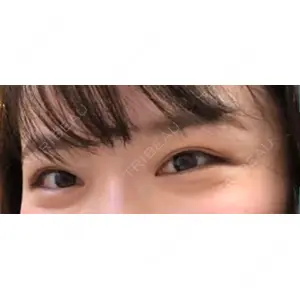 口コミ