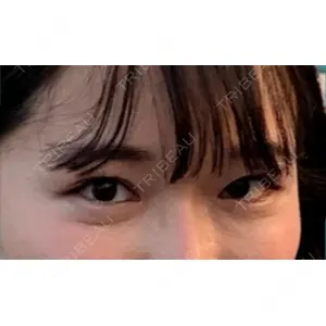 口コミ