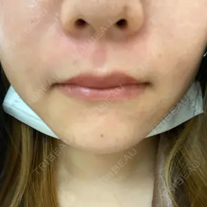 RAISE CLINIC 【レイズクリニック】口コミ