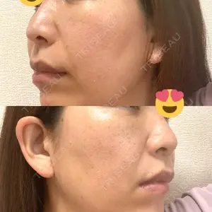 X CLINIC X CLINIC 銀座院口コミ