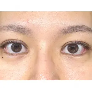 POP美容整形クリニック口コミ