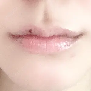 口コミ