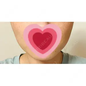 TCB東京中央美容外科 TCB東京中央美容外科 仙台駅前院口コミ