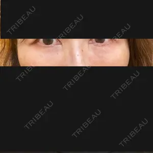 東京イセアクリニック口コミ