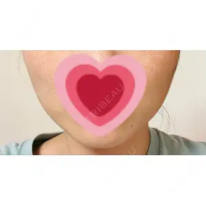 TCB東京中央美容外科 TCB東京中央美容外科 仙台駅前院口コミ