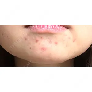 KMクリニック KM新宿クリニック口コミ