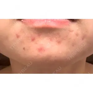 KMクリニック KM新宿クリニック口コミ