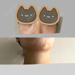 X CLINIC X CLINIC 銀座院口コミ