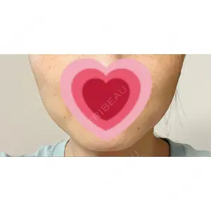 TCB東京中央美容外科 TCB東京中央美容外科 仙台駅前院口コミ