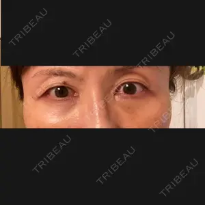 東京イセアクリニック口コミ