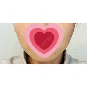 TCB東京中央美容外科 TCB東京中央美容外科 仙台駅前院口コミ