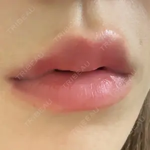 口コミ
