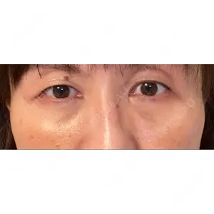 東京イセアクリニック口コミ