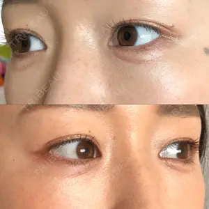 X CLINIC X CLINIC 銀座院口コミ