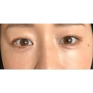 X CLINIC X CLINIC 銀座院口コミ