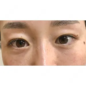 X CLINIC X CLINIC 銀座院口コミ