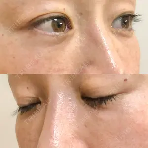 X CLINIC X CLINIC 銀座院口コミ