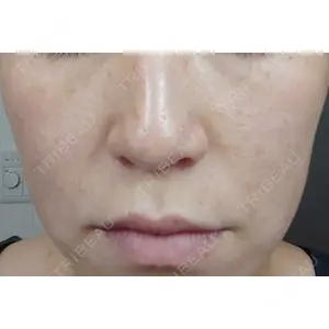 Tケアクリニック浜松町口コミ