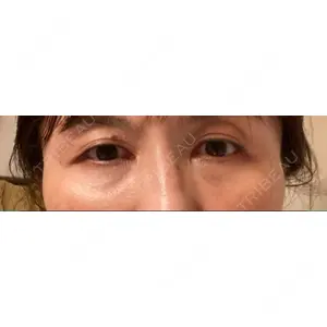 東京イセアクリニック口コミ