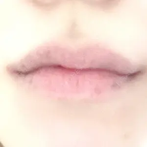 口コミ