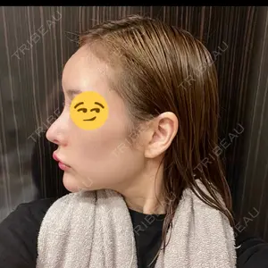 APスキンクリニック銀座口コミ