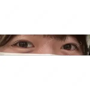 口コミ