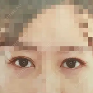 口コミ