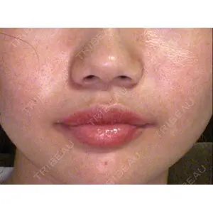 フィラークリニック フィラークリニック 町田院口コミ