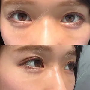 X CLINIC X CLINIC 銀座院口コミ