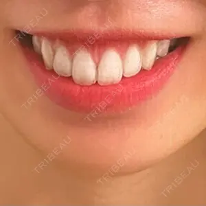 口コミ