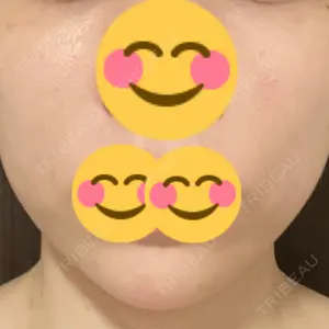 湘南美容クリニック 湘南美容クリニック 銀座院口コミ