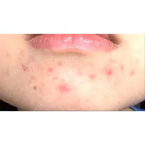 KMクリニック KM新宿クリニック口コミ