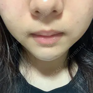 口コミ