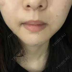 口コミ