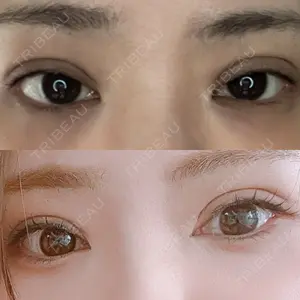口コミ