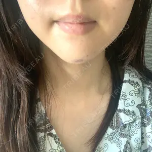 口コミ