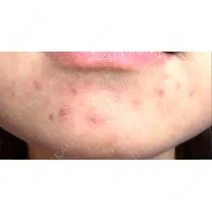 KMクリニック KM新宿クリニック口コミ