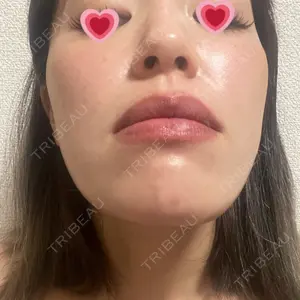 口コミ