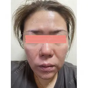 RAISE CLINIC 【レイズクリニック】口コミ