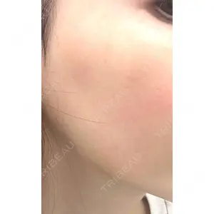 湘南美容クリニック 湘南美容クリニック 静岡院口コミ