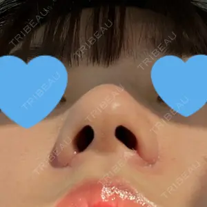 口コミ